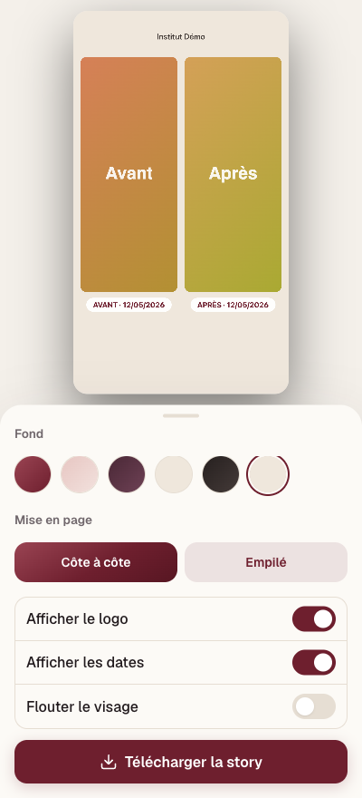 Story avant/après